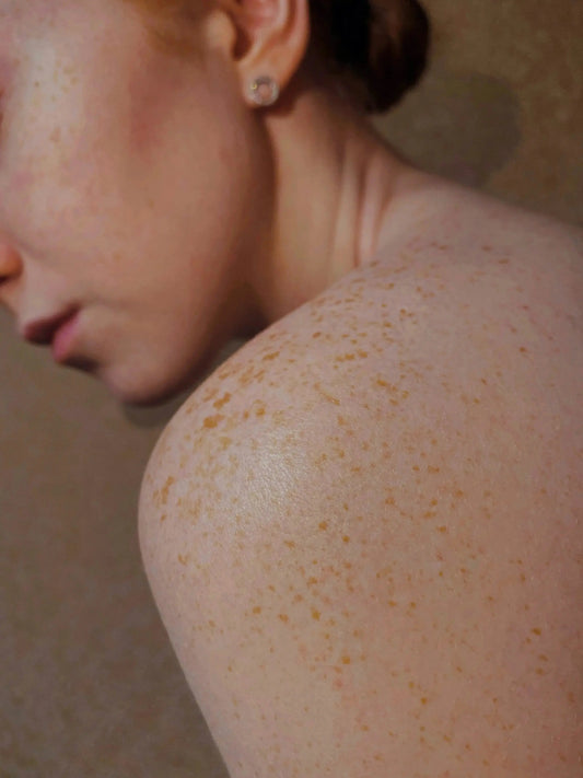 A Guide to Hypoallergenic Moisturisers - Skinstation