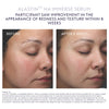 ALASTIN HA Immerse Serum 30ml