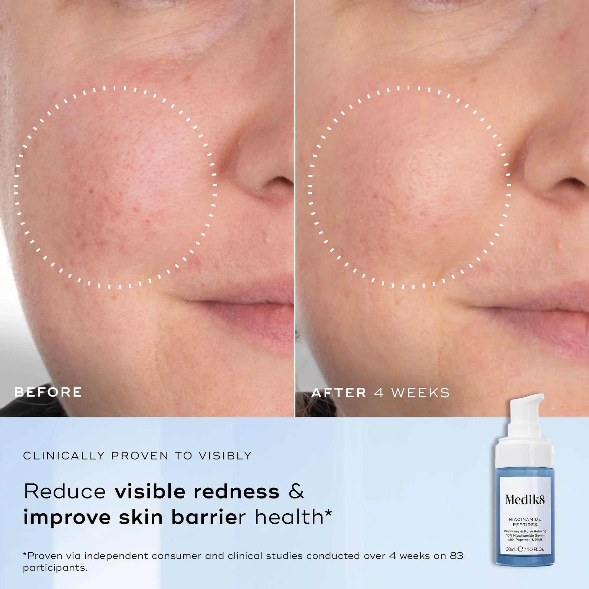 Medik8 Niacinamide Peptides 30ml Medik8