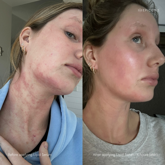 Epicutis Lipid Serum 30ml Epicutis