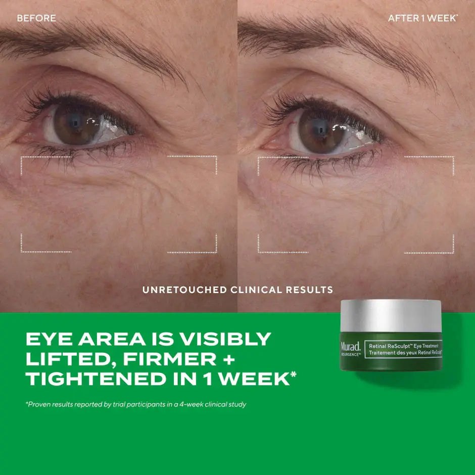 Murad Retinal ReSculpt Eye Treatment 15ml Murad