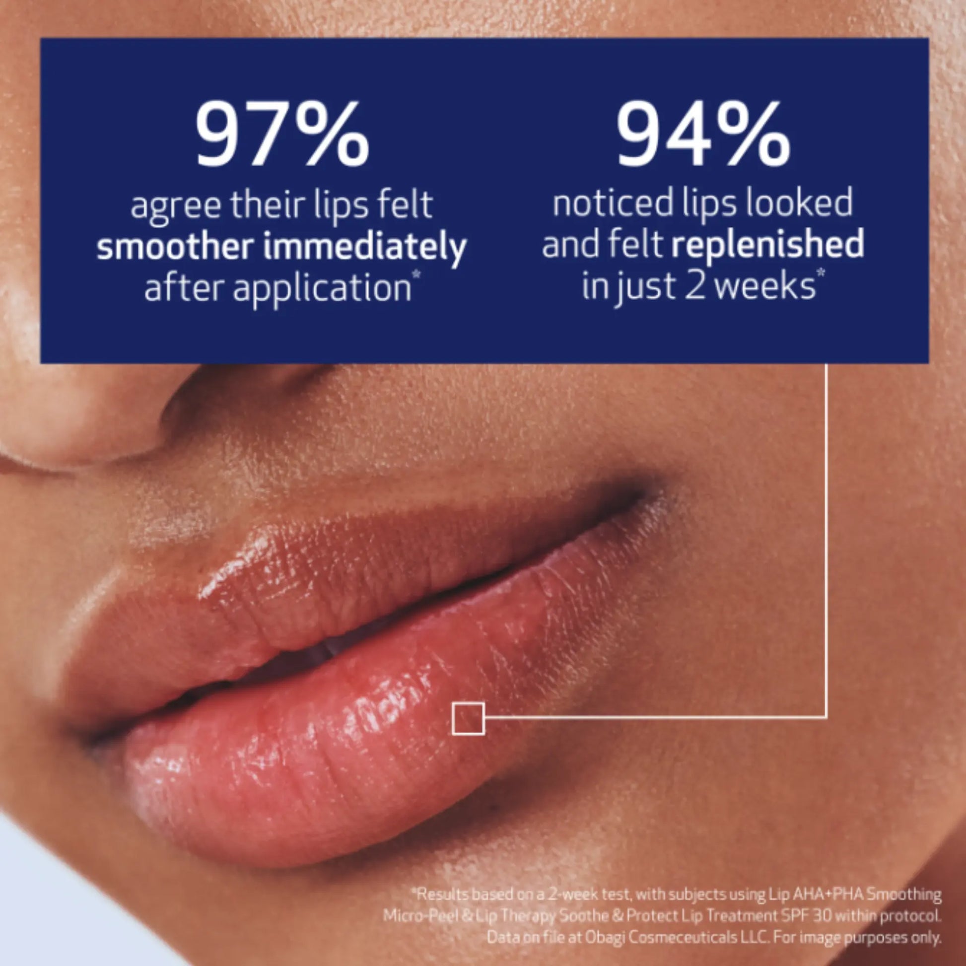 Obagi Lip Therapy AHA + PHA Smoothing Peel 15ml Obagi