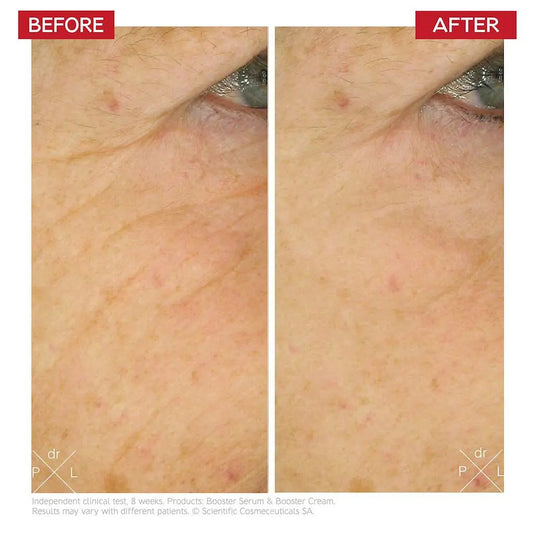 Dr. LEVY Switzerland Age-Reverse Stem Cell Cure Kit