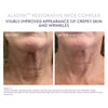 ALASTIN Restorative Neck Complex 50ml