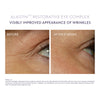 ALASTIN Restorative Eye Complex 18ml
