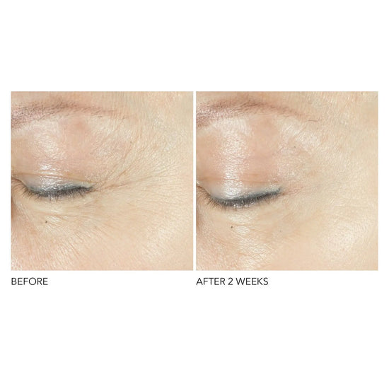 Dr Dennis Gross Advanced Retinol & Ferulic Triple Correction Eye Serum 15ml Dr Dennis Gross