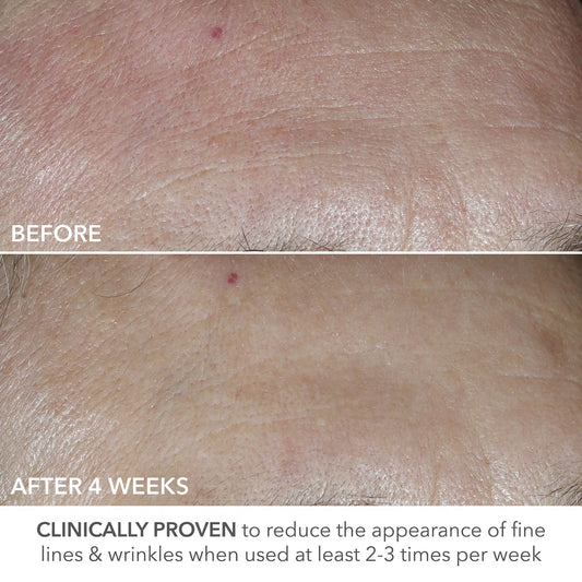 Dr. Dennis Gross Advanced Retinol + Ferulic Overnight Wrinkle Treatment - 30ml