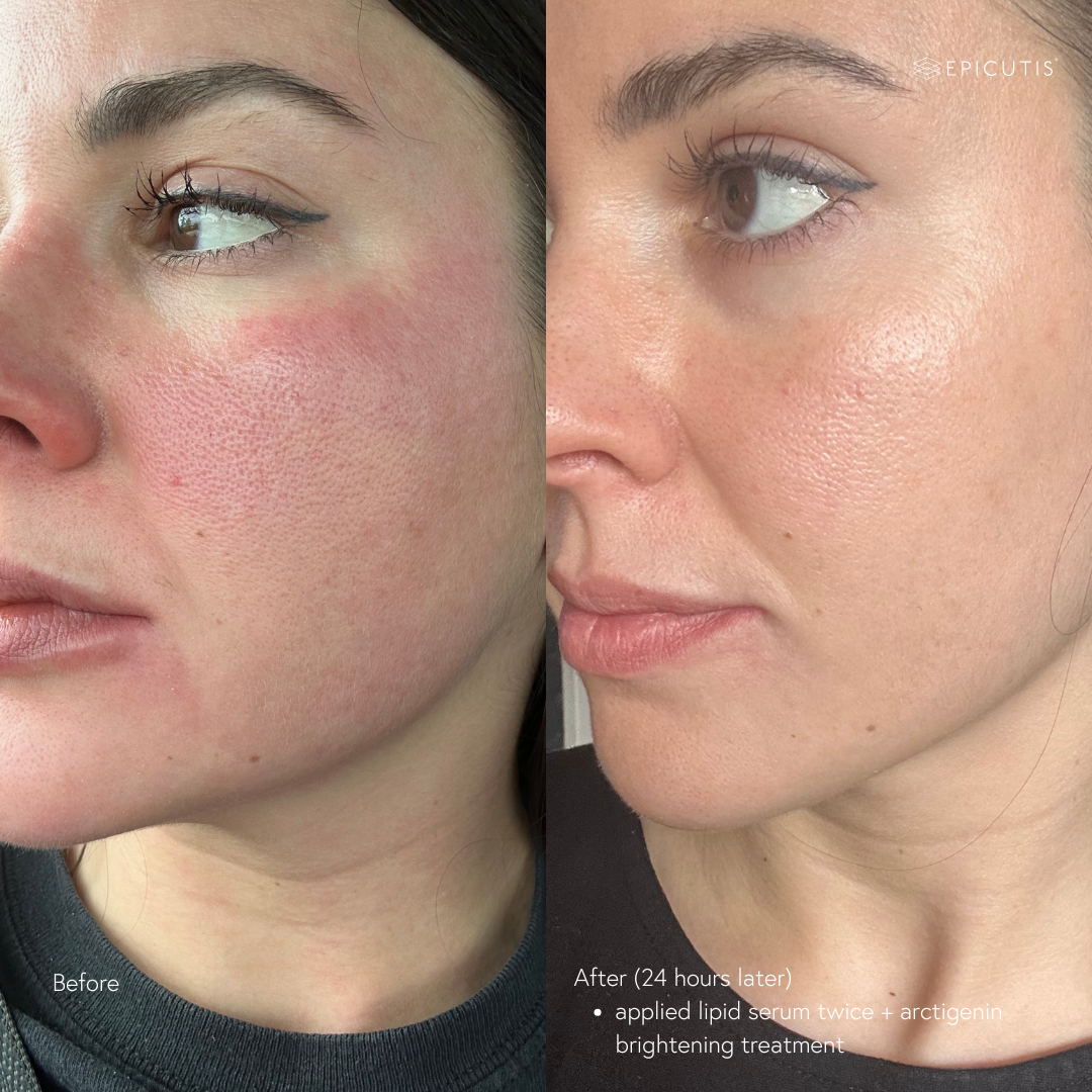 Epicutis Lipid Serum 30ml Epicutis