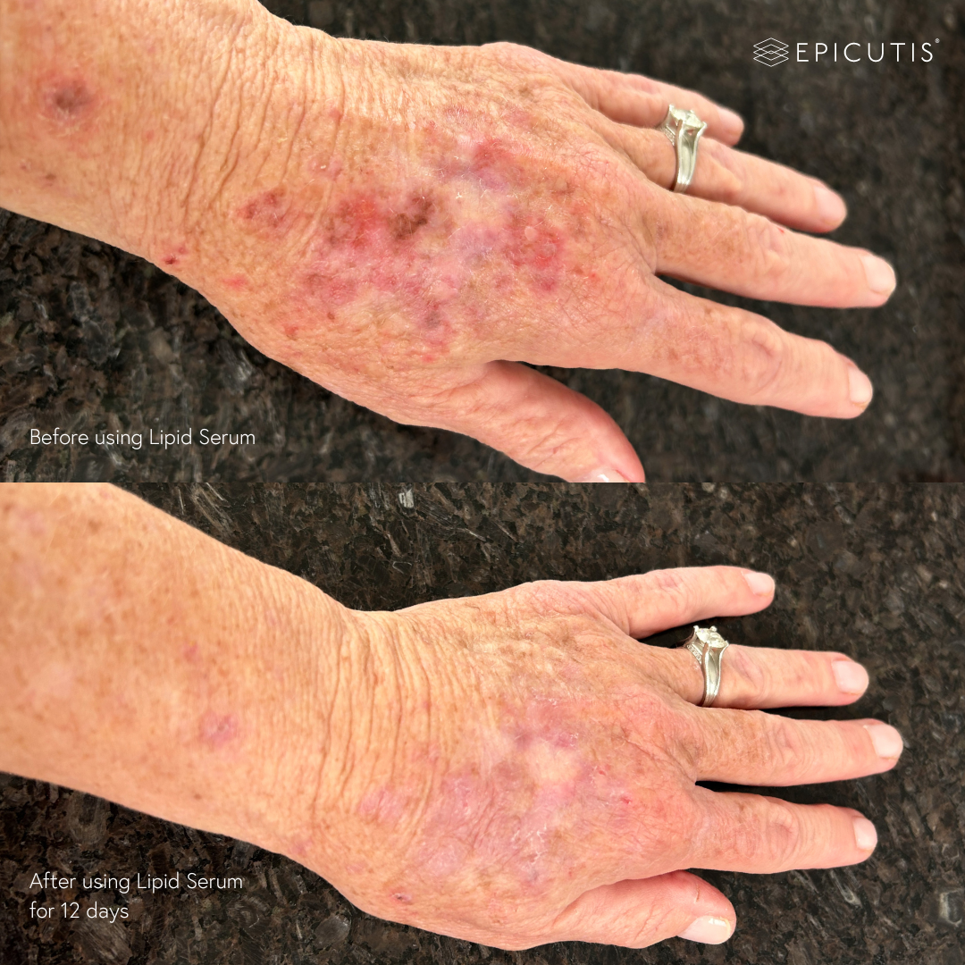 Epicutis Lipid Serum 30ml Epicutis