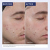 Obagi CLENZIDERM M.D. Resurfacing Multi-Acid Peel Pads