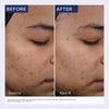 Obagi CLENZIDERM M.D. Resurfacing Multi-Acid Peel Pads