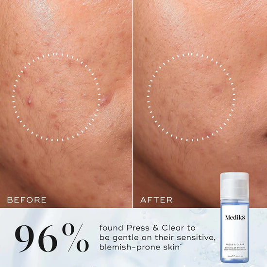 Medik8 Press & Clear Refill 150ml Medik8