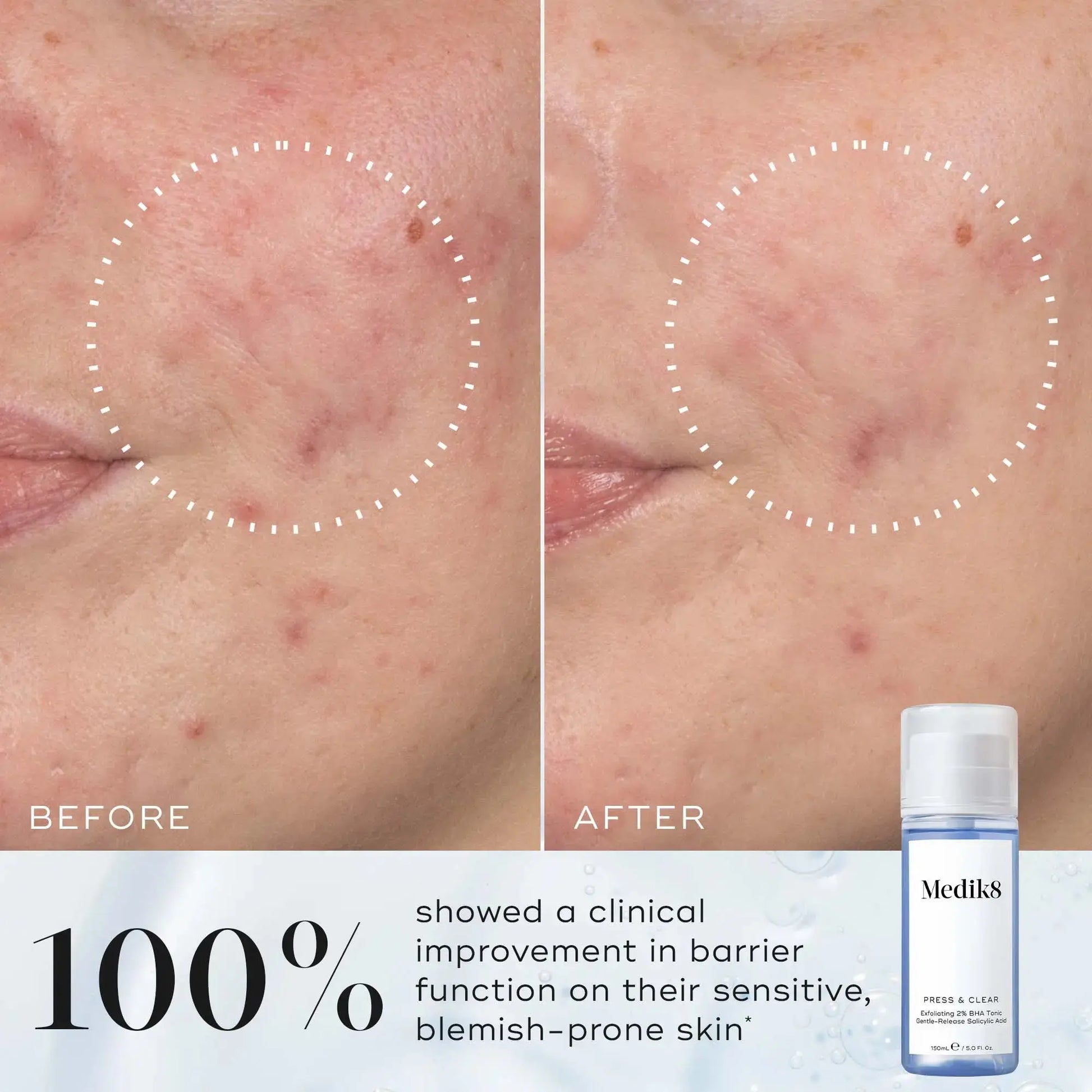 Medik8 Press & Clear 150ml Medik8