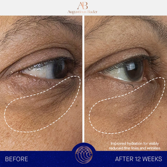 Augustinus Bader The Eye Cream 15ml Augustinus Bader