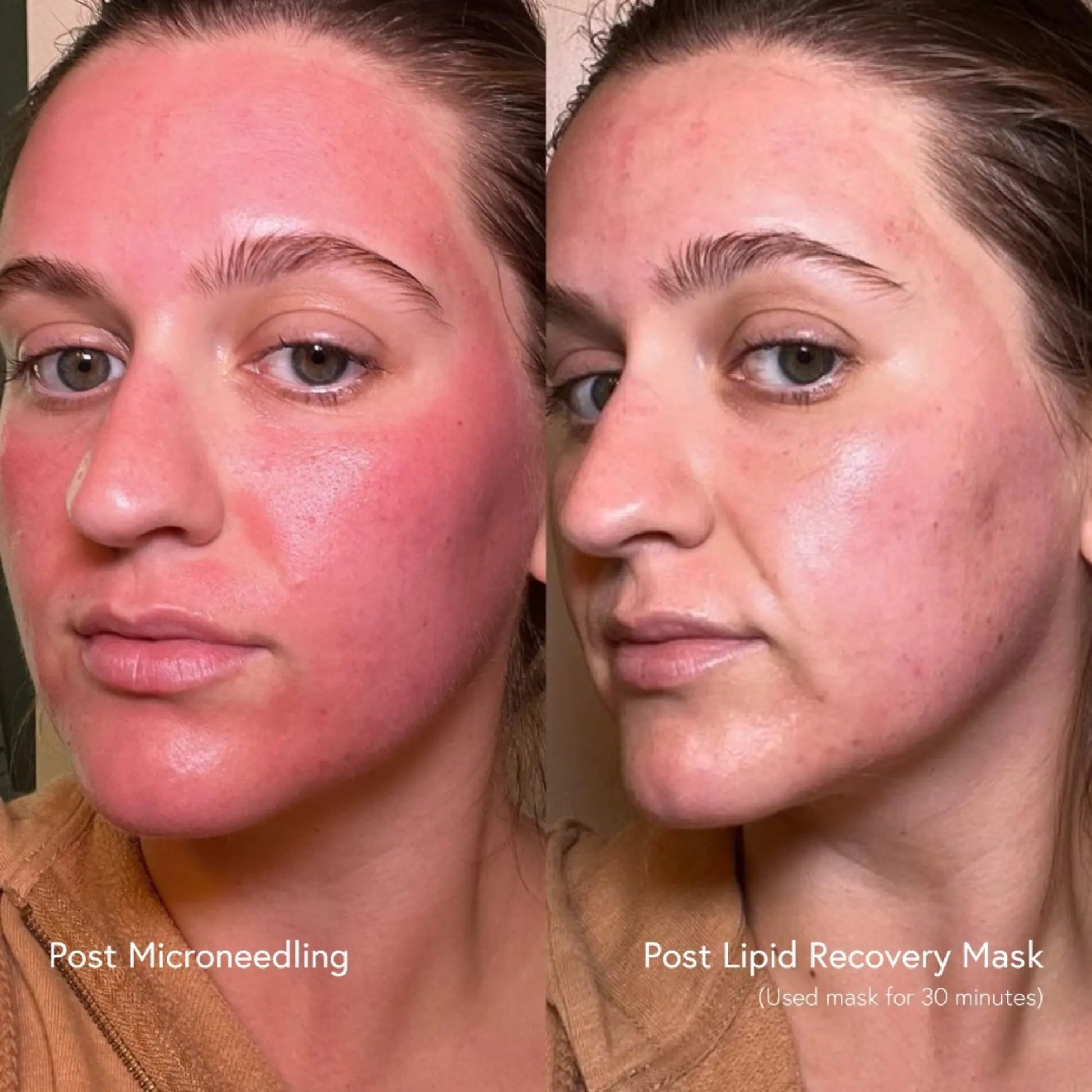 Epicutis Lipid Recovery Mask Epicutis
