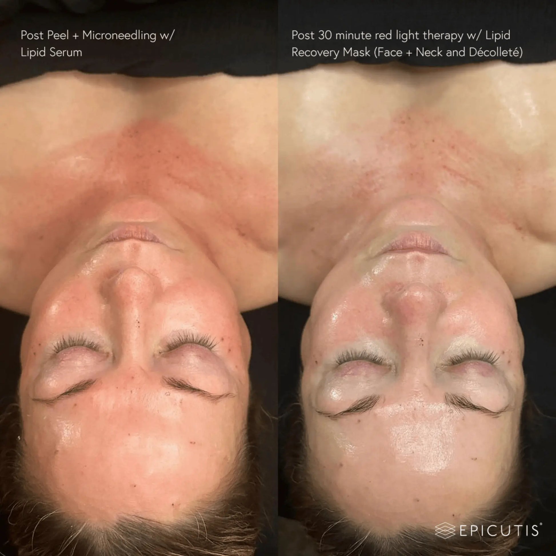 Epicutis Lipid Recovery Mask Epicutis