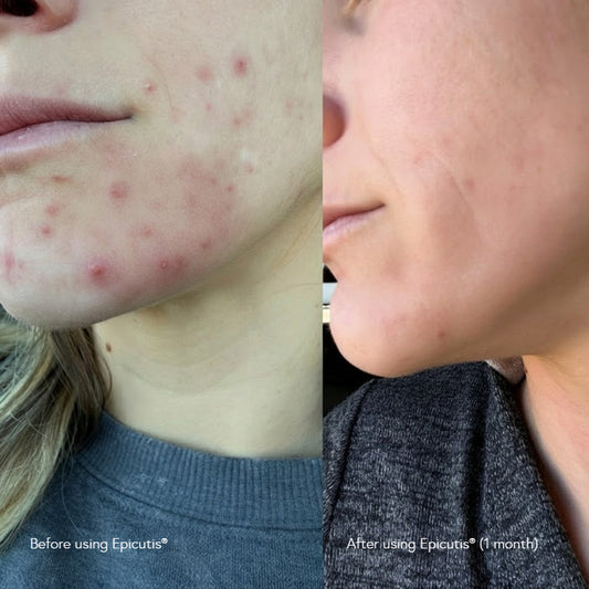 Epicutis Cleansing Essentials Set (Oil Cleanser 100ml + Enzyme Exfoliating Powder 40g) Epicutis