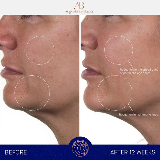 Augustinus Bader The Rich Cream 30ml Augustinus Bader