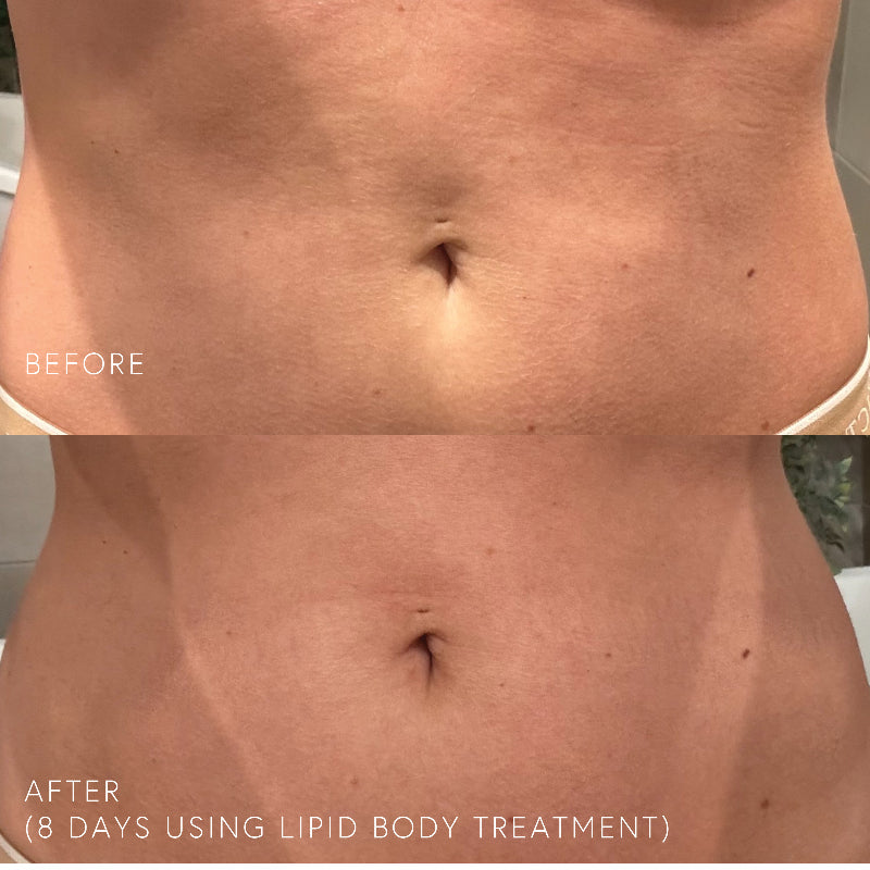 Epicutis Lipid Body Treatment 220ml Epicutis