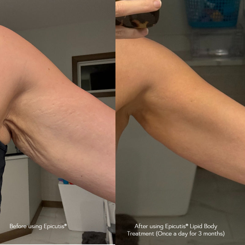 Epicutis Lipid Body Treatment 220ml Epicutis