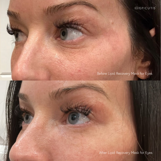 Epicutis Lipid Recovery Mask for Eyes (Pack of 5) Epicutis