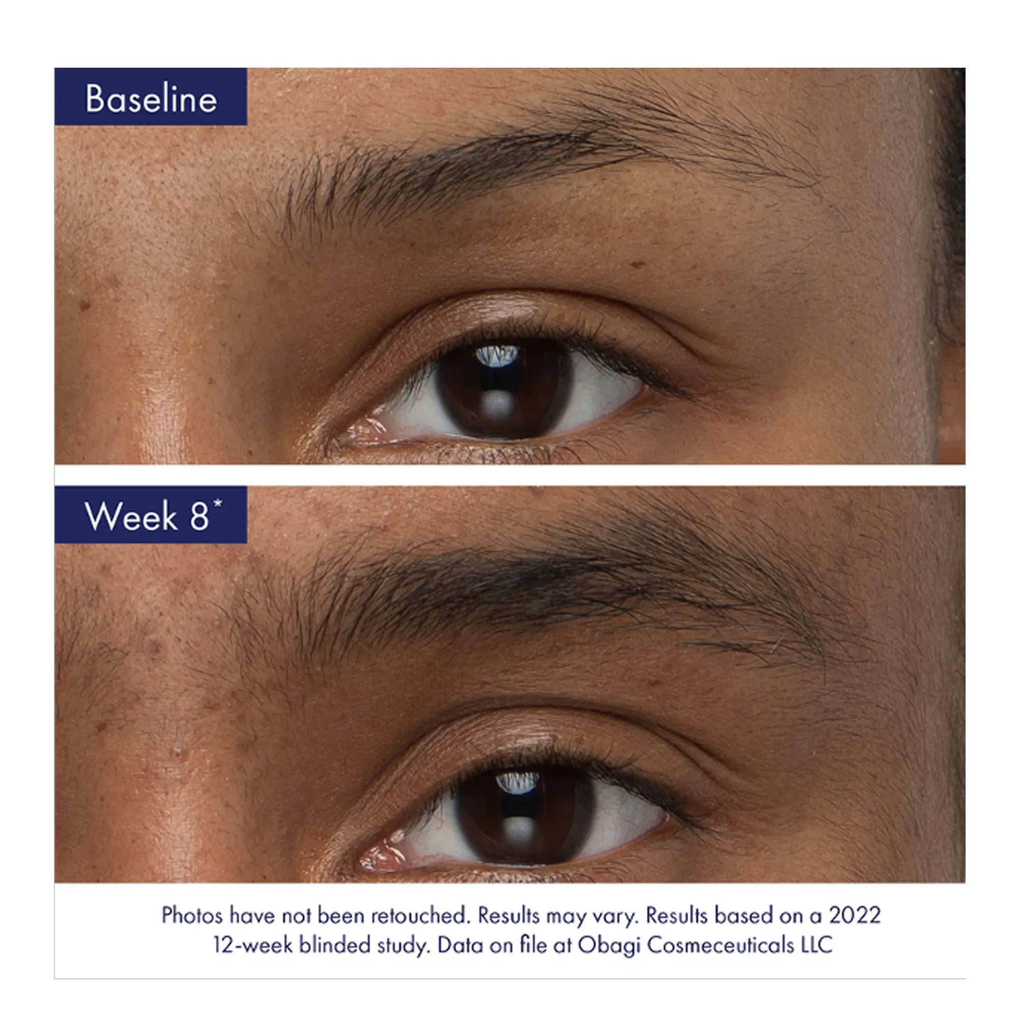 Obagi Nu-Cil Brow - 5ml | Brow Enhancing Serum | SKINSTATION
