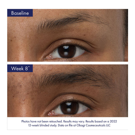 Obagi Nu-Cil® Eyebrow Boosting Serum 5ml Obagi