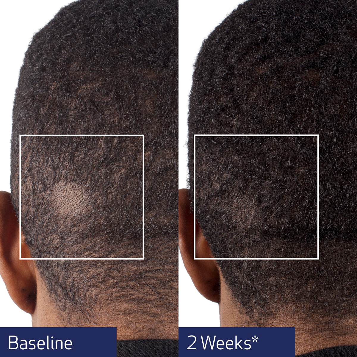 Obagi Nu-Cil® BioStim™ Scalp Serum 60ml Obagi