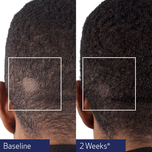 Obagi Nu-Cil® BioStim™ Scalp Serum 60ml Obagi