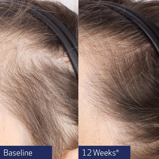 Obagi Nu-Cil® BioStim™ Scalp Serum 60ml Obagi