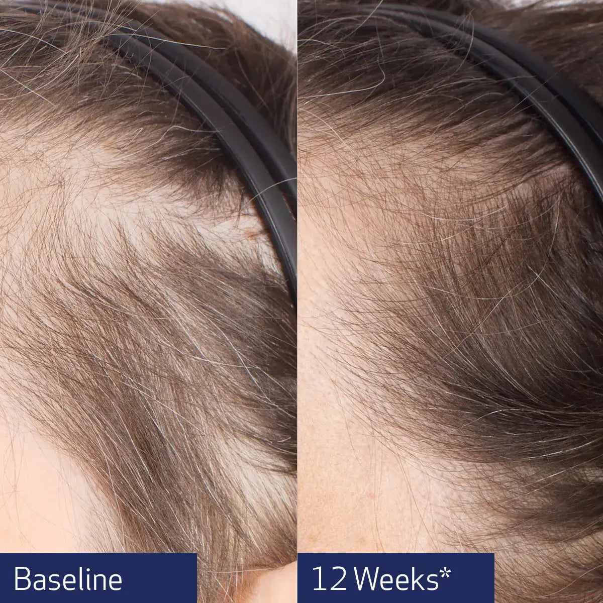 Obagi Nu-Cil® BioStim™ Scalp Serum 60ml Obagi