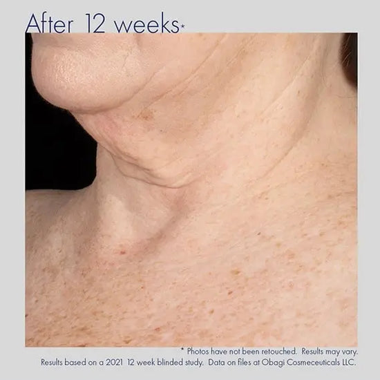 Obagi ELASTIderm Neck and Décolleté Concentrate 60ml Obagi