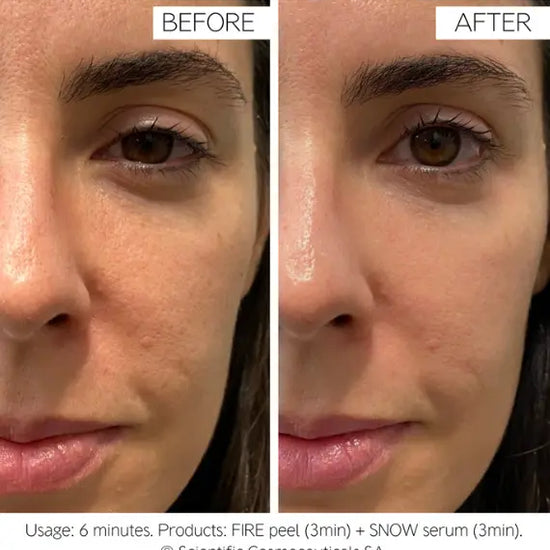 Dr. LEVY Switzerland Fire & Snow (4x10ml) DR Levy Switzerland