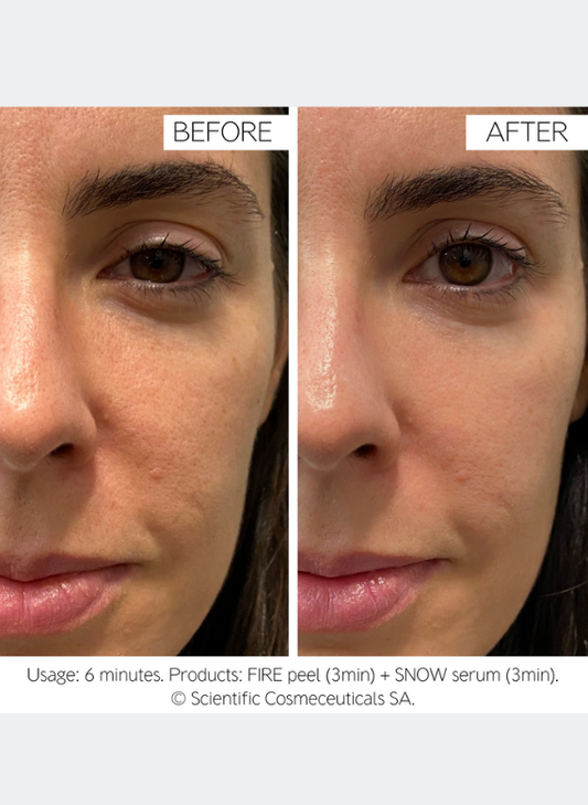 Dr. LEVY Switzerland Fire & Snow (4x10ml)