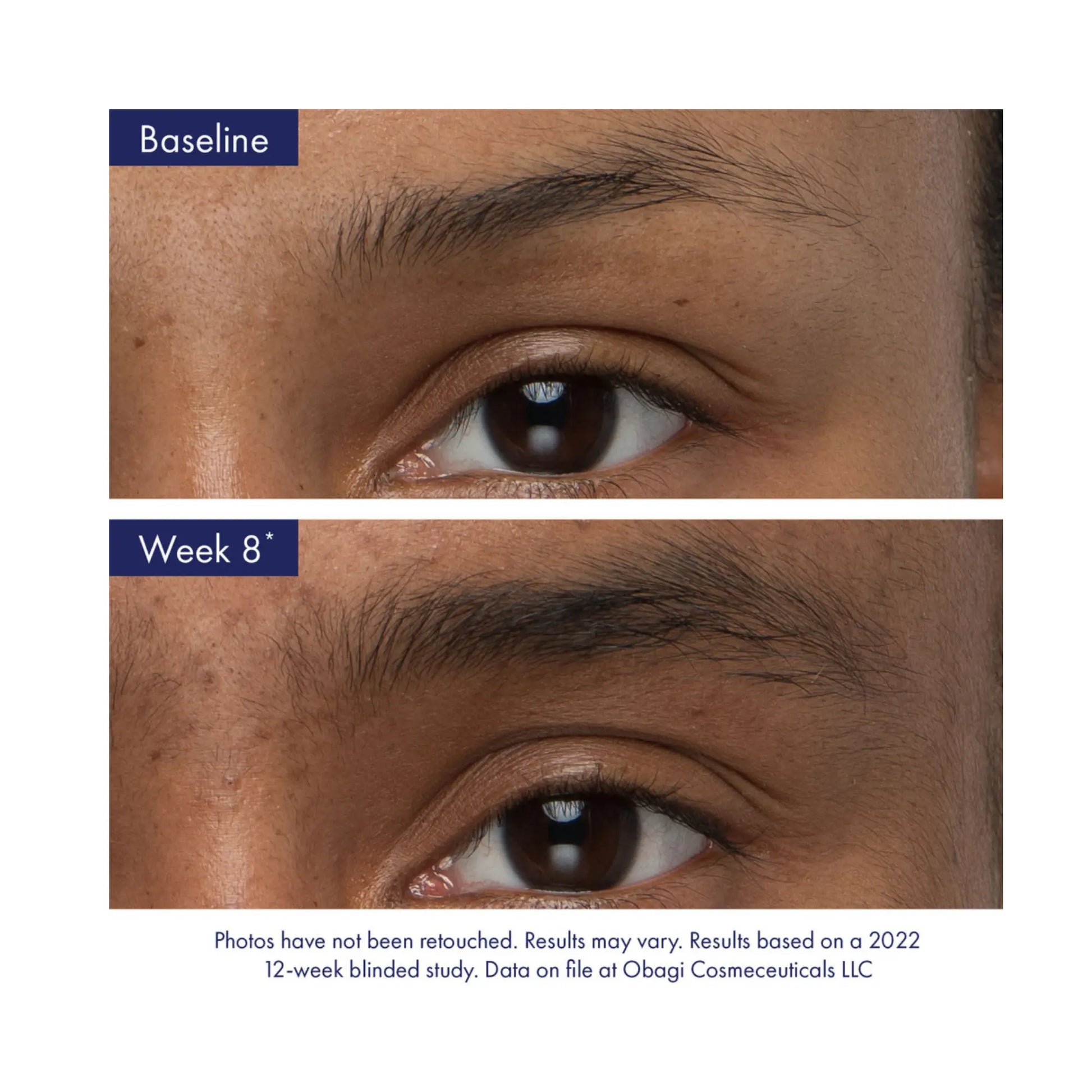 Obagi Nu-Cil® Eyebrow Boosting Serum 5ml Obagi